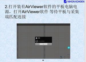心电图机的操作流程视频,从启动到结束的全方位指导