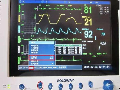 心电监护技术操作视频,掌握生命守护技能